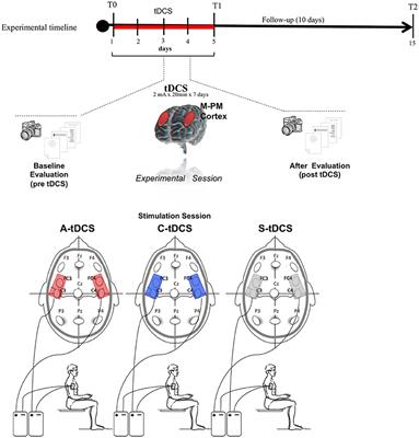 Cathodal Transcranial Direct Current Stimulation Improves Focal Hand Dystonia in Musicians: A Two-Case Study